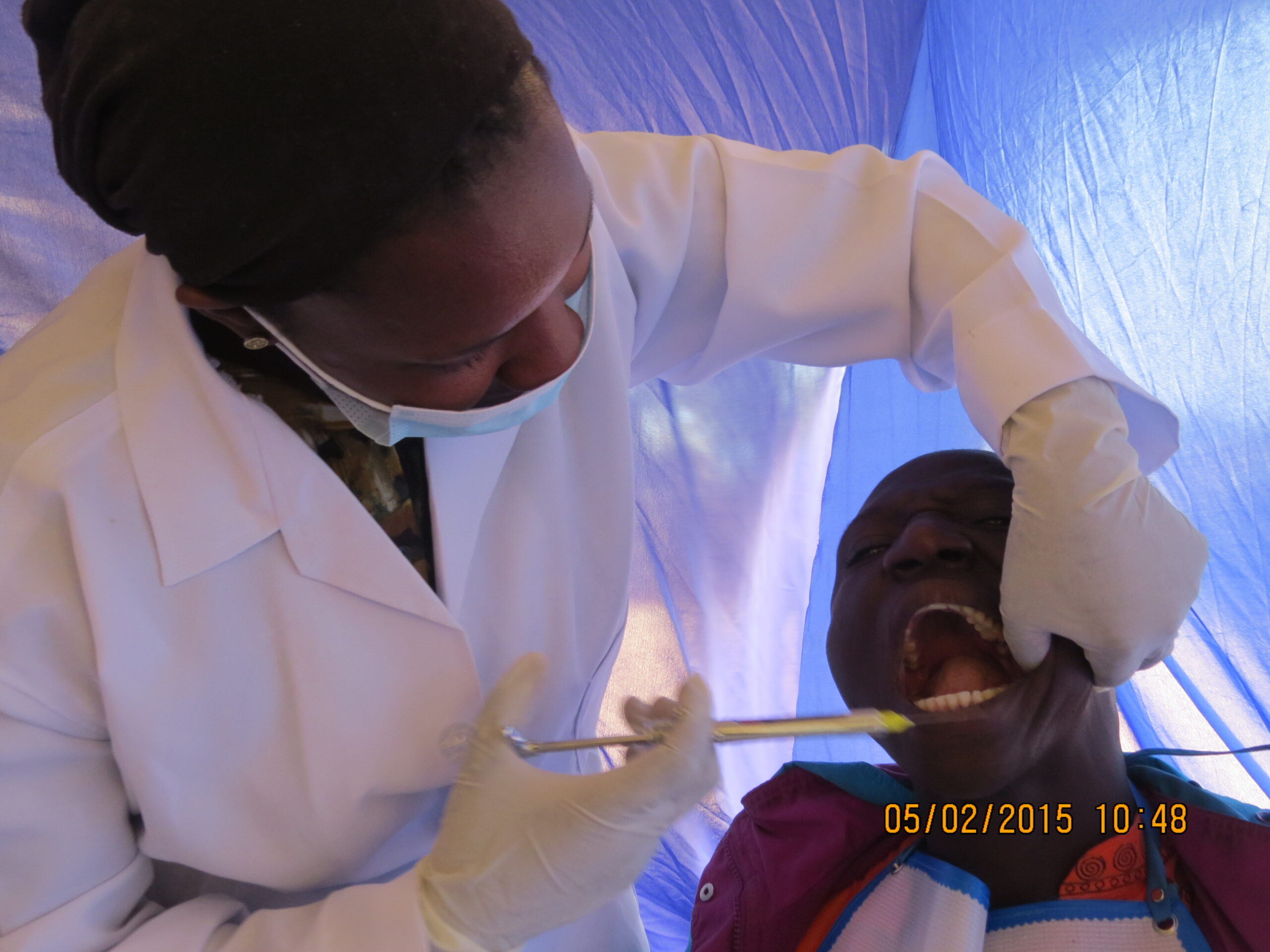 Tooth extraction